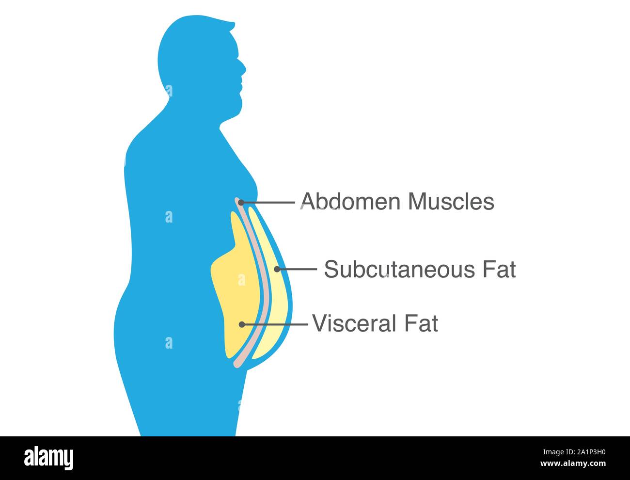 Visceral fat and subcutaneous fat that accumulate around your waistline. Illustration about medical diagram. Stock Vector