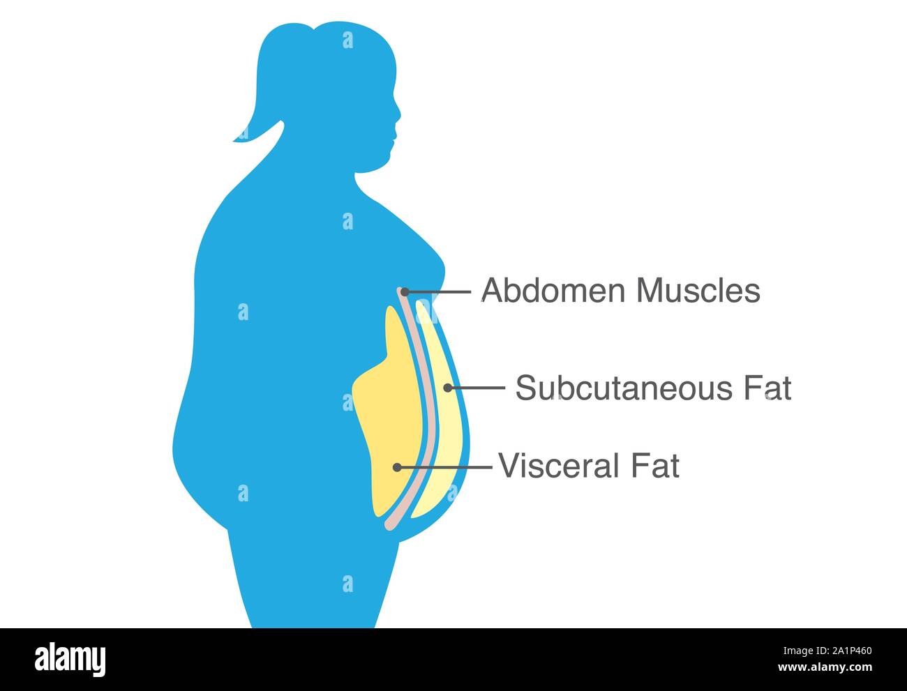 Visceral fat and subcutaneous fat that accumulate around waistline of woman. Stock Vector