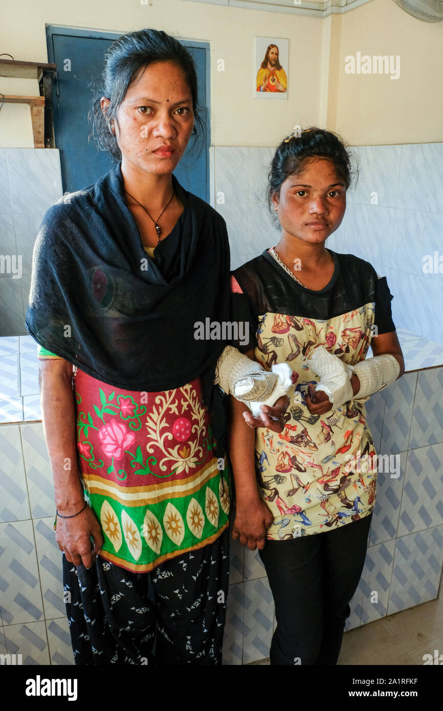 Leprosy patients at the Catholic Mission Hospital Borang of the Diocese of Tezpur in the state of Assam, northeastern India, Asia Stock Photo