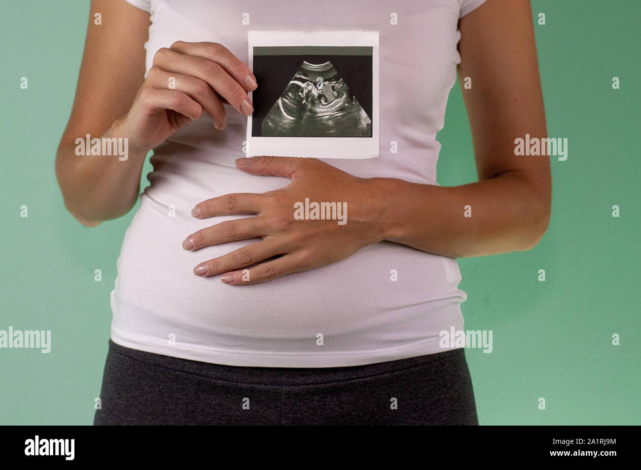 The girl is holding a snapshot of an ultrasound twin in the fourth week ...