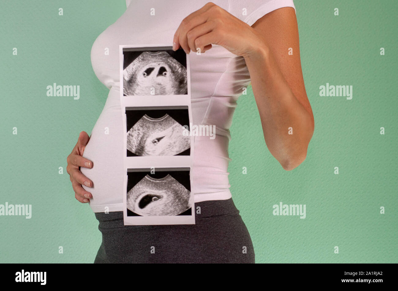 The girl is holding a snapshot of an ultrasound twin in the fourth week ...