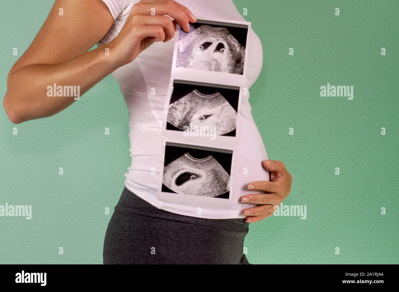 The girl is holding a snapshot of an ultrasound twin in the fourth week ...