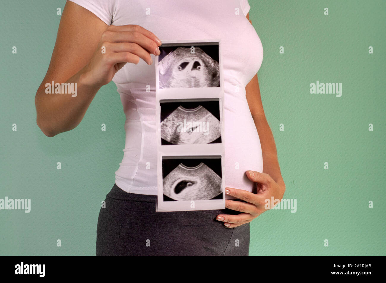 The girl is holding a snapshot of an ultrasound twin in the fourth week ...