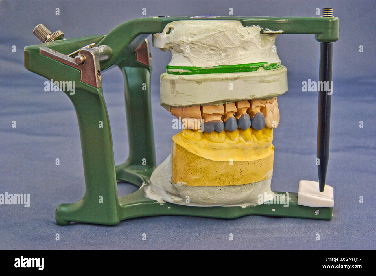 Dentist articulator with mouth model Stock Photo Alamy