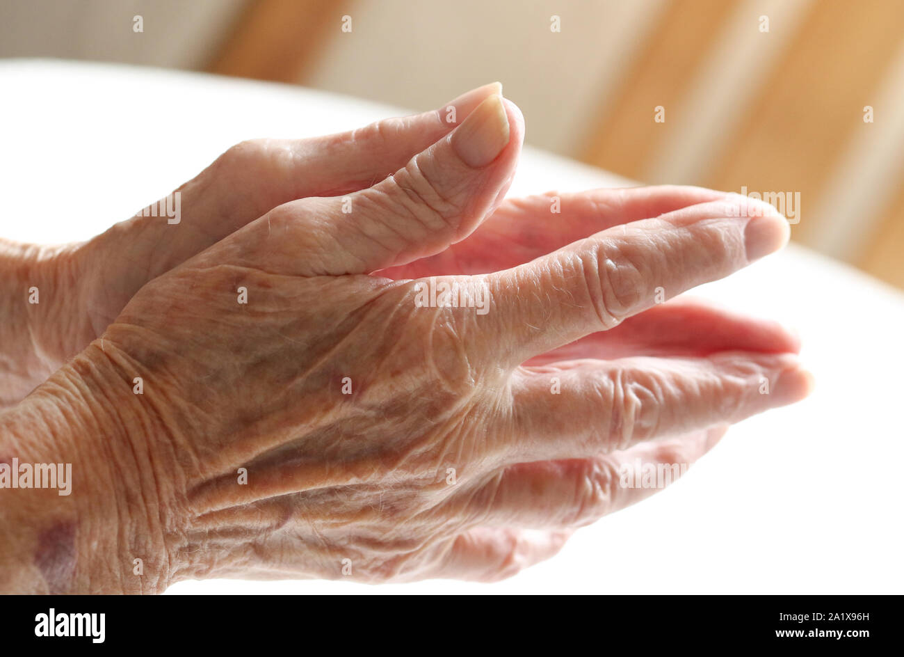 An elderly ladies praying hands suffering from Parkinson's disease. Stock Photo