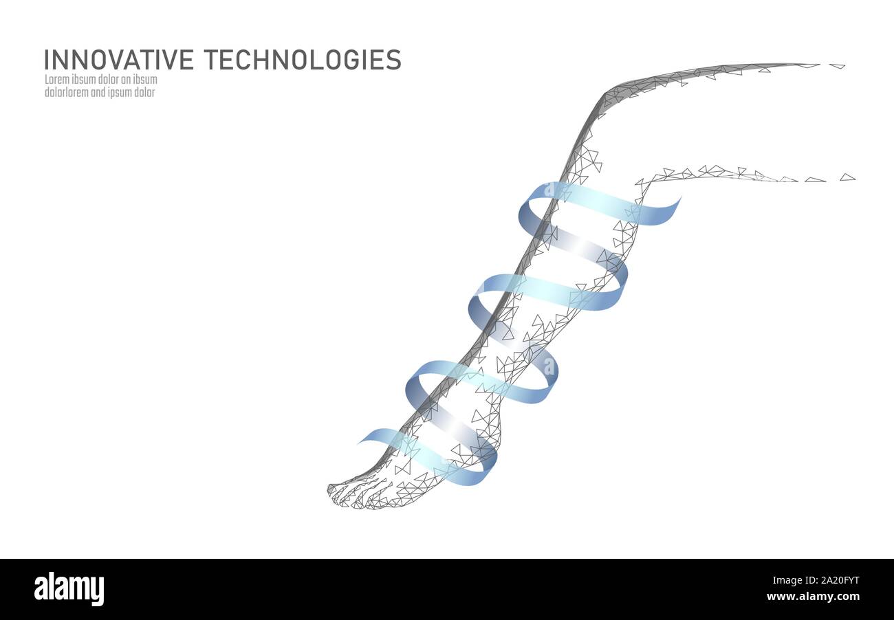 Varicose veins leg and foot hires stock photography and images Alamy