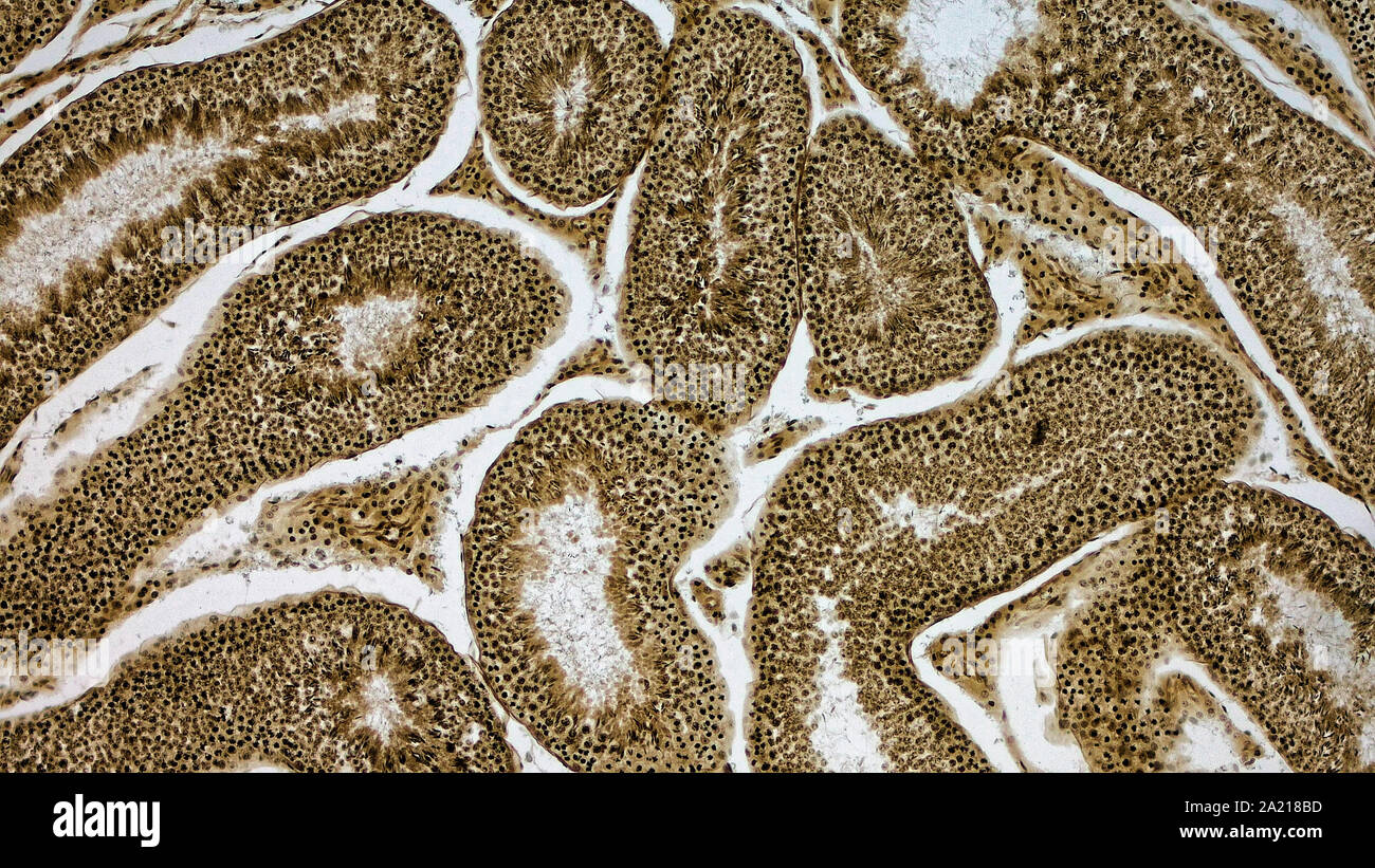 Rabbit testicle hires stock photography and images Alamy