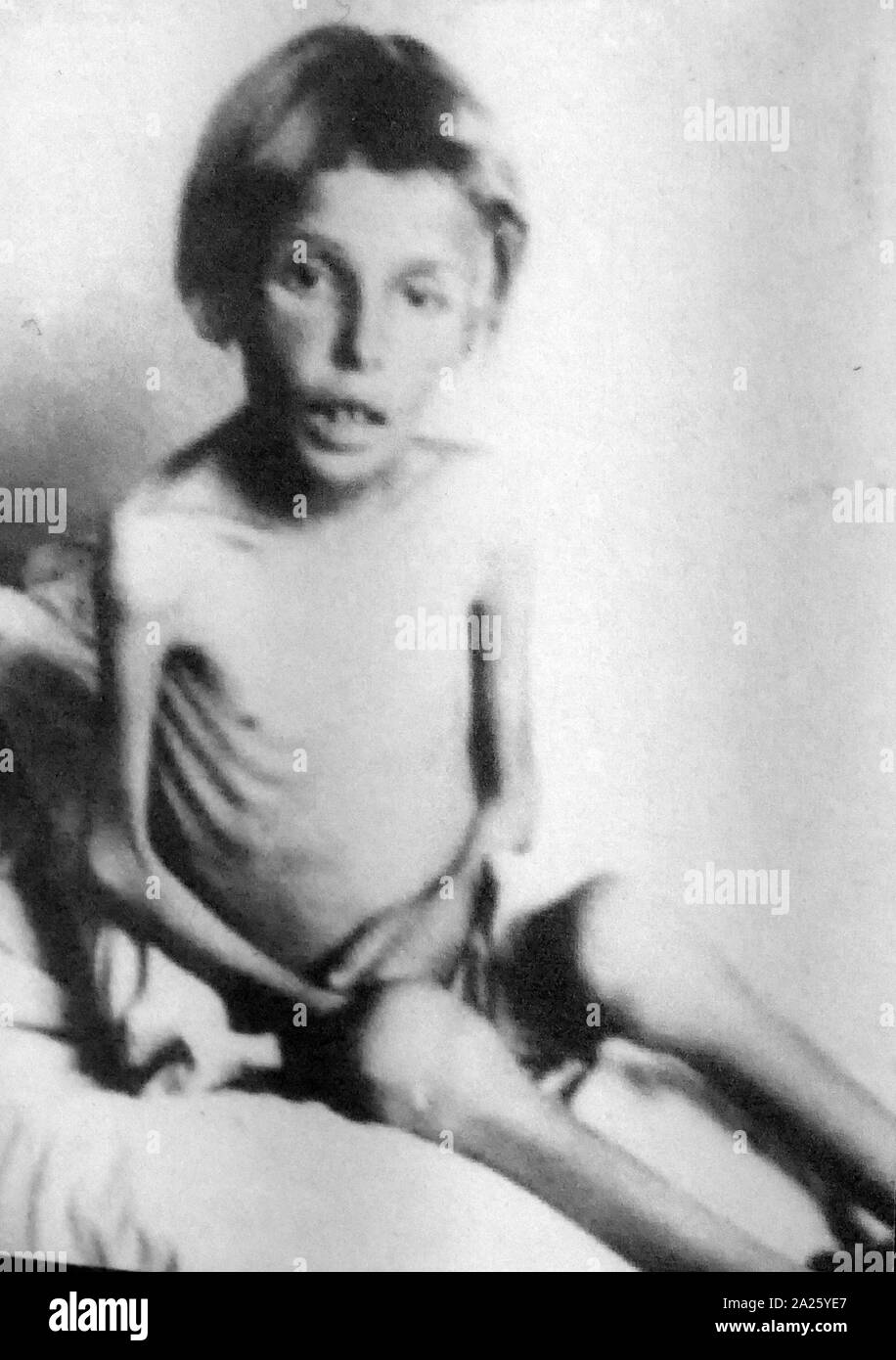 Photograph of a young emaciated Holocaust survivor. The Holocaust, also referred to as the Shoah, was a genocide during the Second World War in which some six million European Jews were murdered. Stock Photo