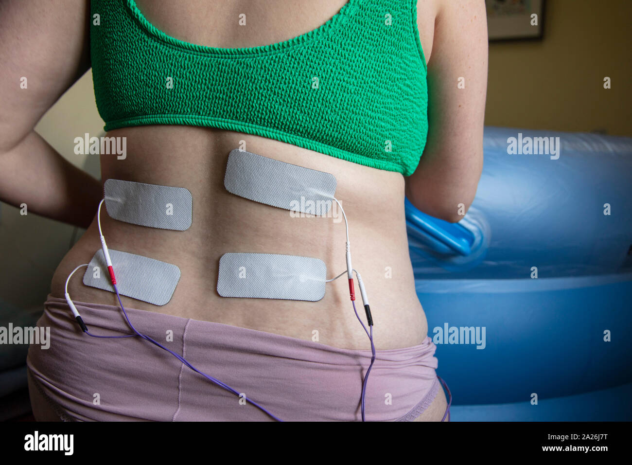 A pregnant woman in labour wearing a tens machine as pain relief Stock Photo