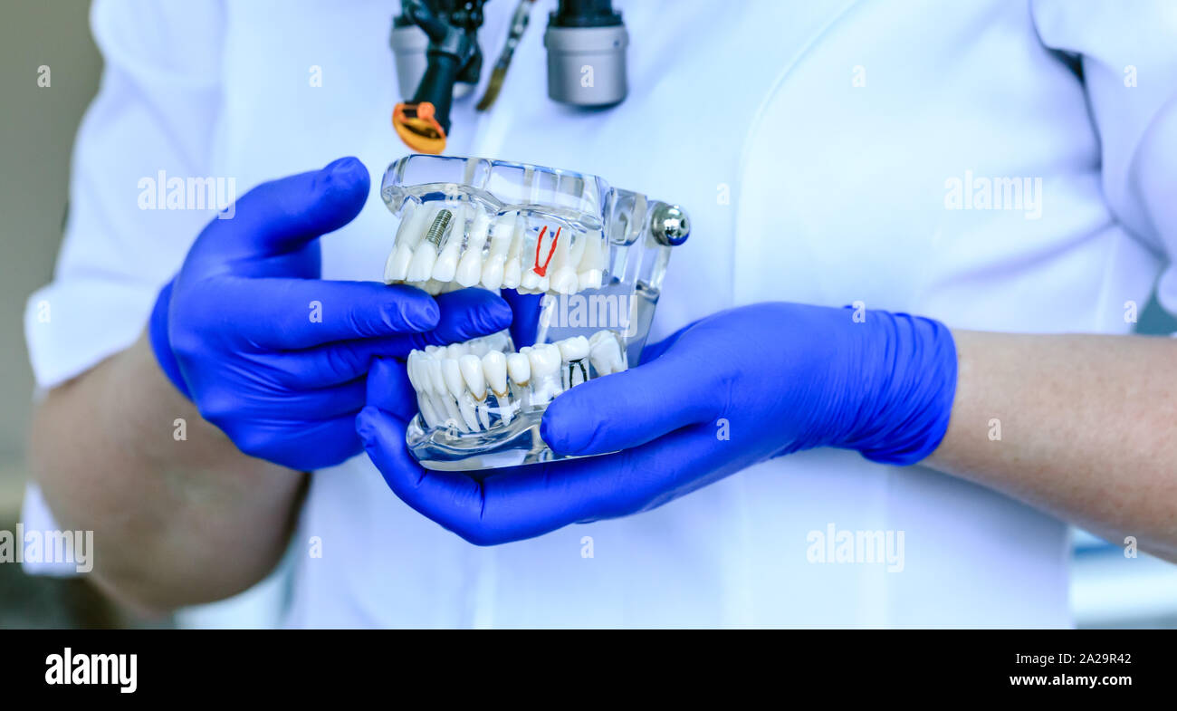 Real doctor holds a dental teeth model in dentistry clinic. Oral care ...