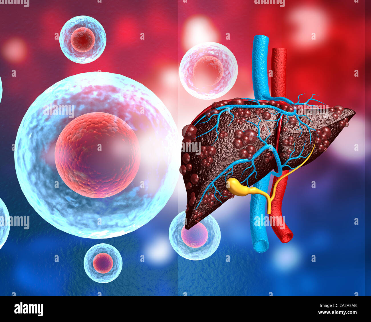 viral infection on human  liver. 3d illustration Stock Photo