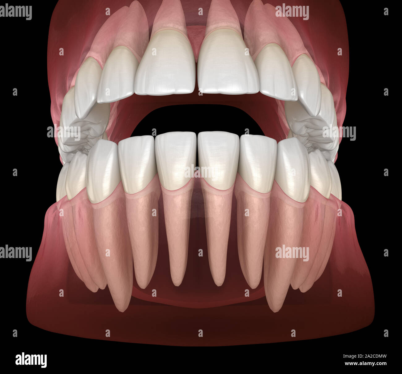 Morphology of mandibular and maxillary human gum and teeth. Medically