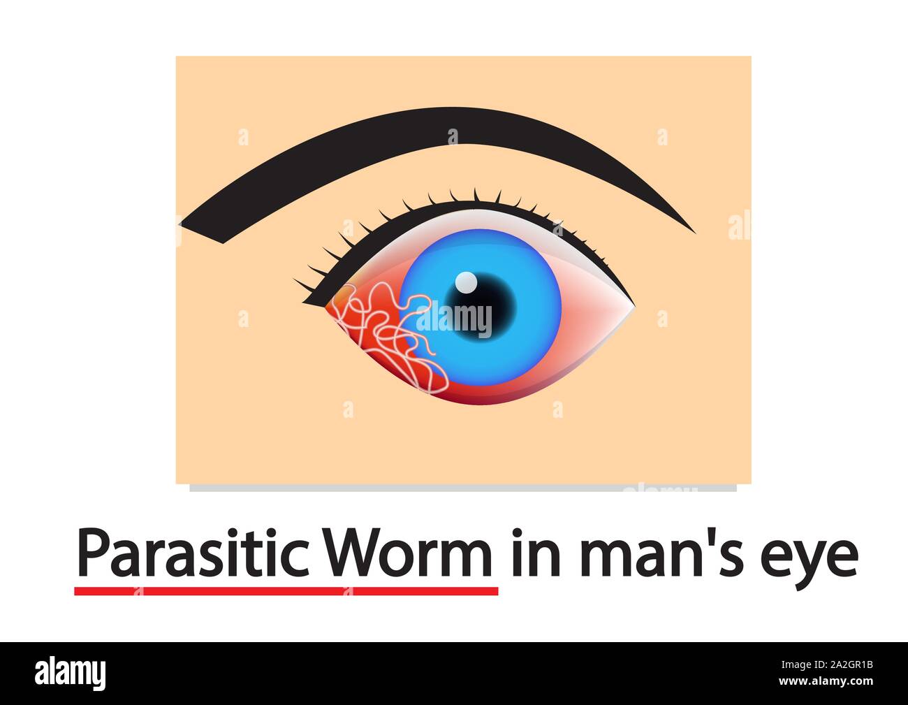 Closeup Parasitic Worms in human's eye, vector art design Stock Vector