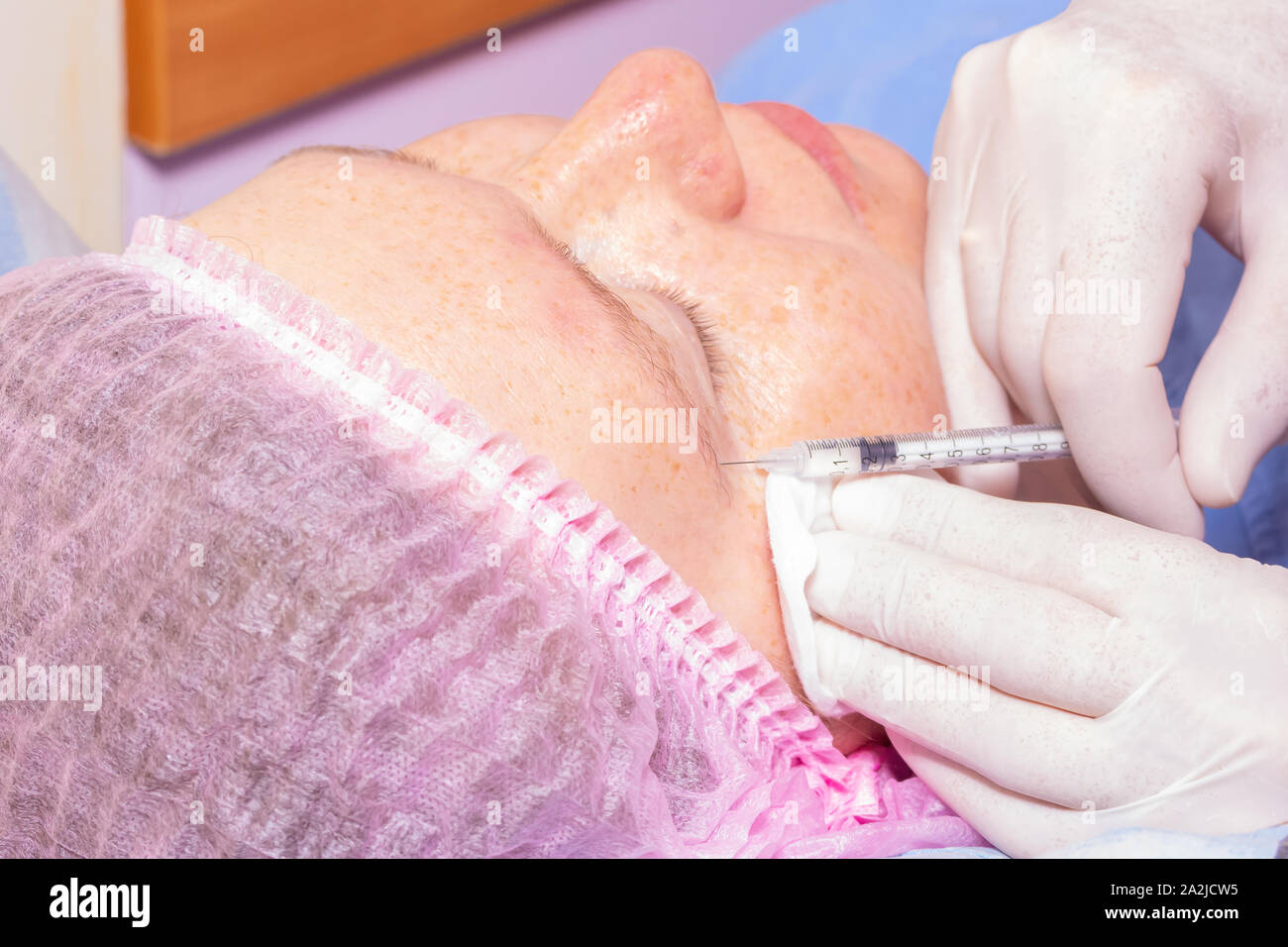 Hyaluronic acid injection for facial rejuvenation procedure. Close-up Stock Photo