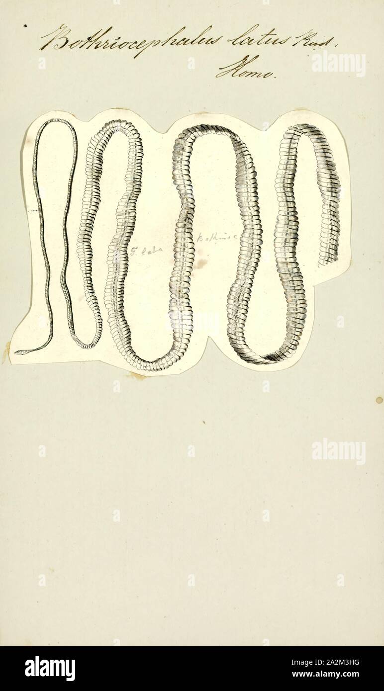 Bothriocephalus latus, Print, Diphyllobothrium is a genus of tapeworms which can cause diphyllobothriasis in humans through consumption of raw or undercooked fish. The principal species causing diphyllobothriasis is Diphyllobothrium latum, known as the broad or fish tapeworm, or broad fish tapeworm. D. latum is a pseudophyllid cestode that infects fish and mammals. D. latum is native to Scandinavia, western Russia, and the Baltics, though it is now also present in North America, especially the Pacific Northwest. In Far East Russia, D. klebanovskii, having Pacific salmon as its second Stock Photo
