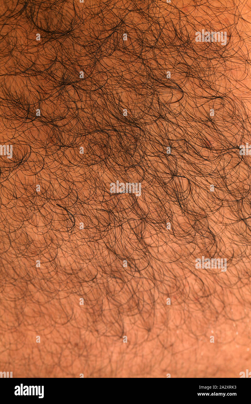 Close up of a hairy skin Stock Photo - Alamy