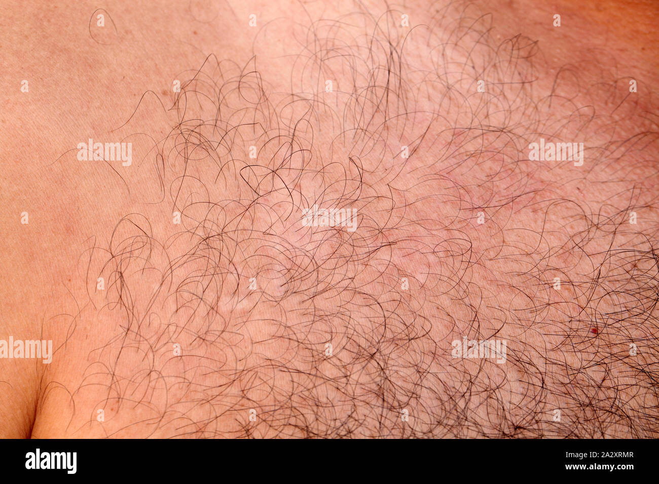Hairy skin hi-res stock photography and images - Alamy