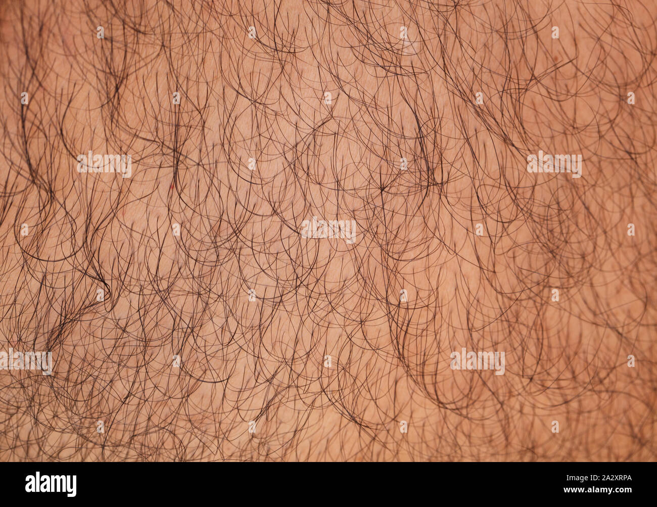 Close up of a hairy skin Stock Photo - Alamy