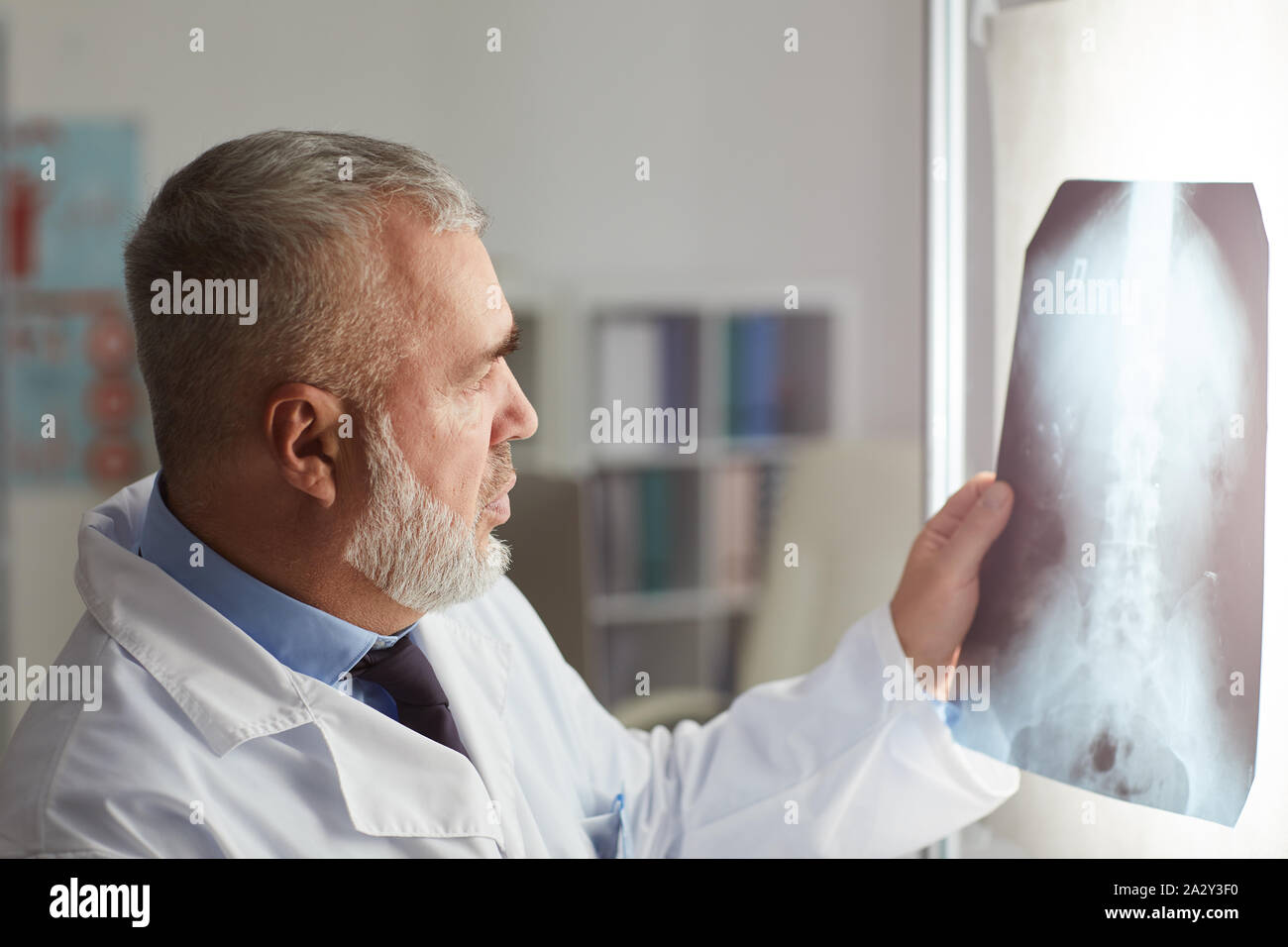 Senior radiologist holding x-ray image in his hand and examining it ...