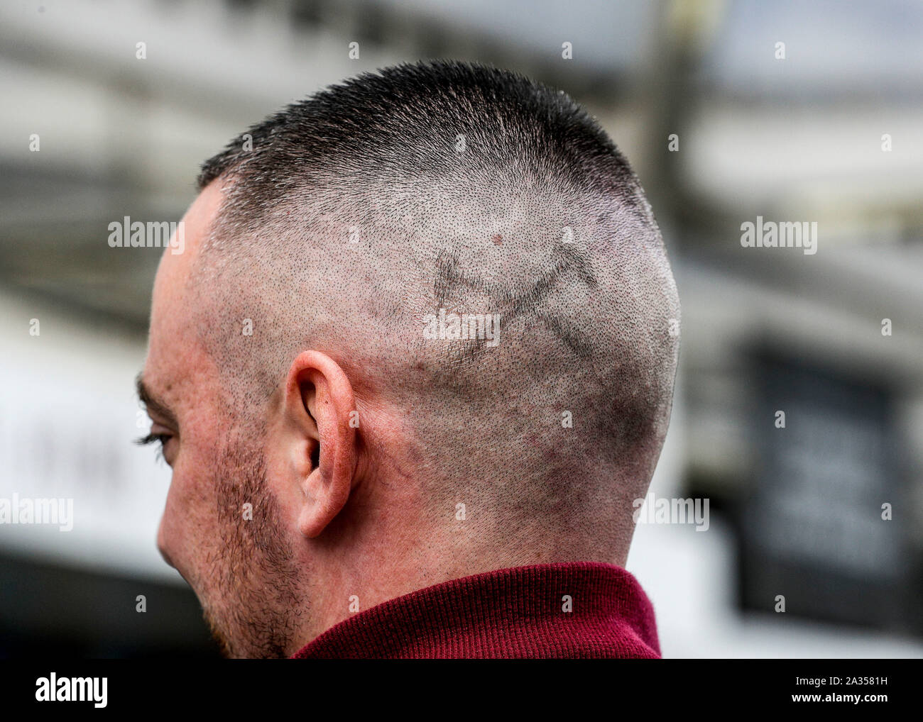 London Stadium, London, UK. 5th Oct, 2019. English Premier League Football,  West Ham United versus Crystal Palace; West Ham United fan with a shaved  Irons logo on head outside the London Stadium
