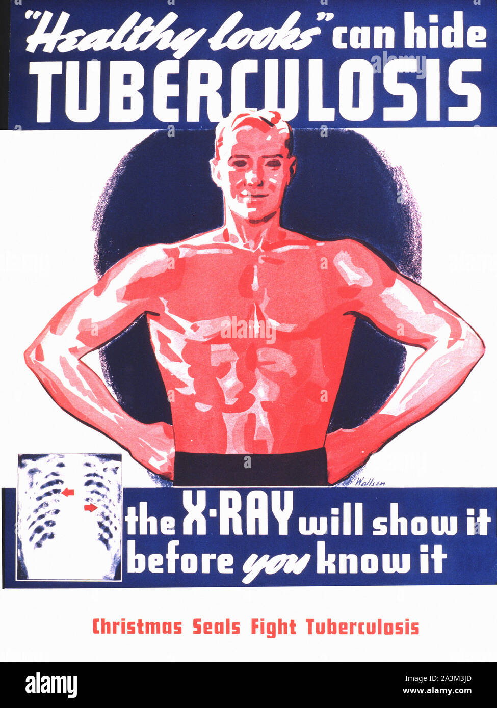 Tuberculosis X-Ray - Vintage poster Stock Photo