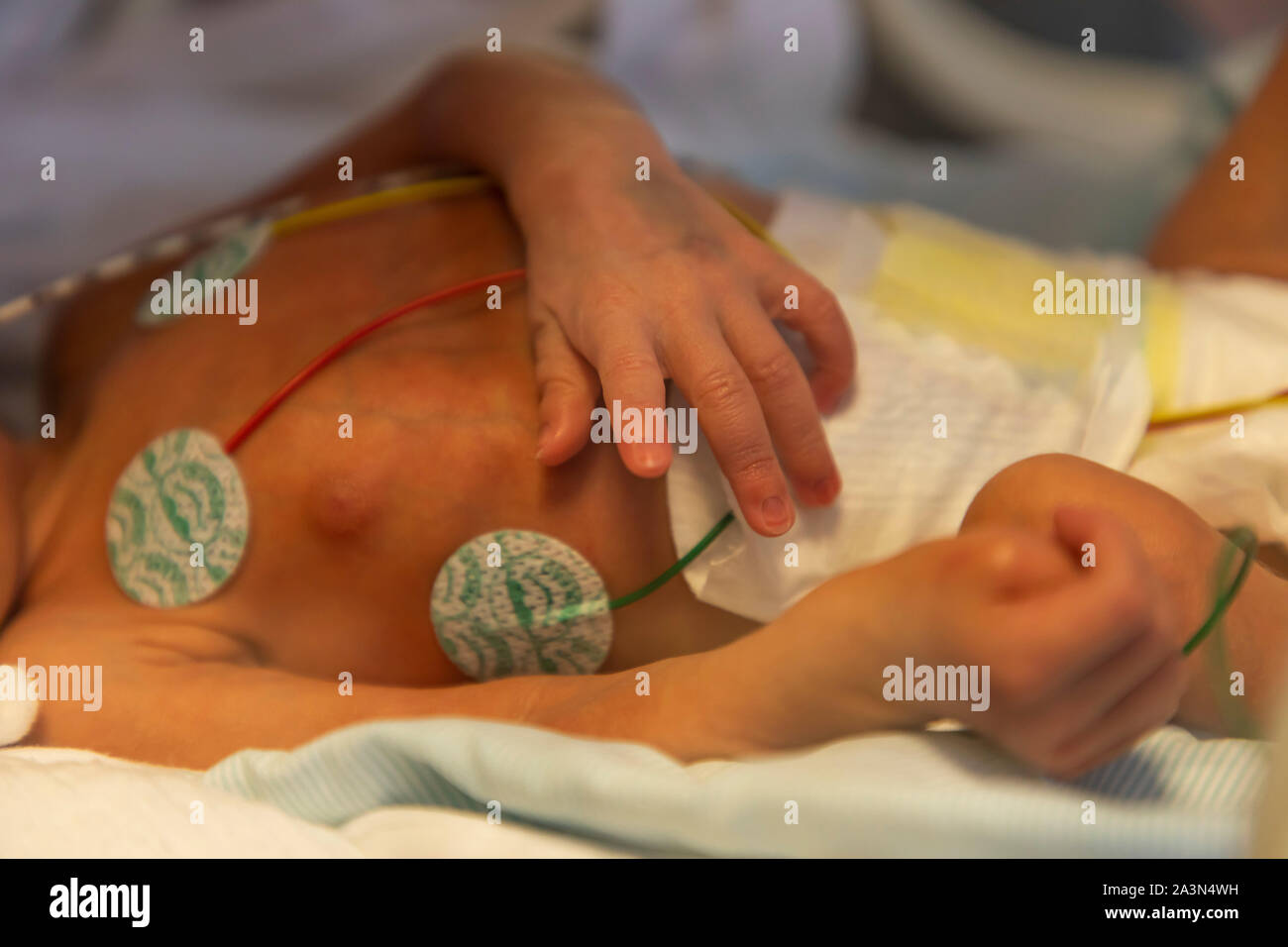 Premature birth ward in a hospital, neonatology department, premature infants in an incubator, Stock Photo