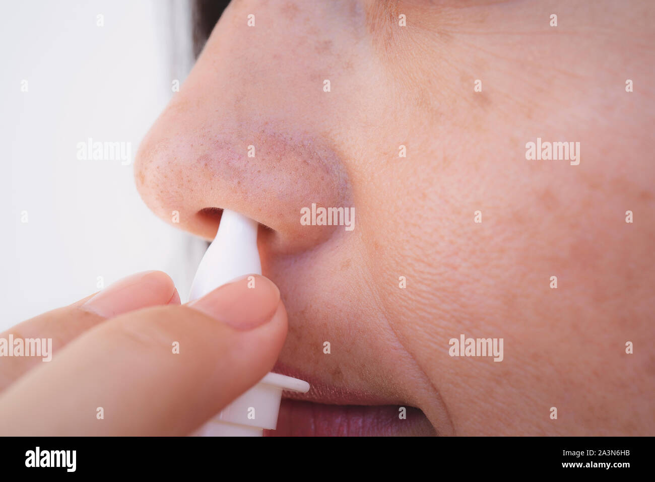 Illness And Sickness. Closeup Of Beautiful Woman Feeling Sick Dripping Nasal Drops In Blocked Nose. Portrait Female Sprays Cold And Sinus Medicine In Stock Photo