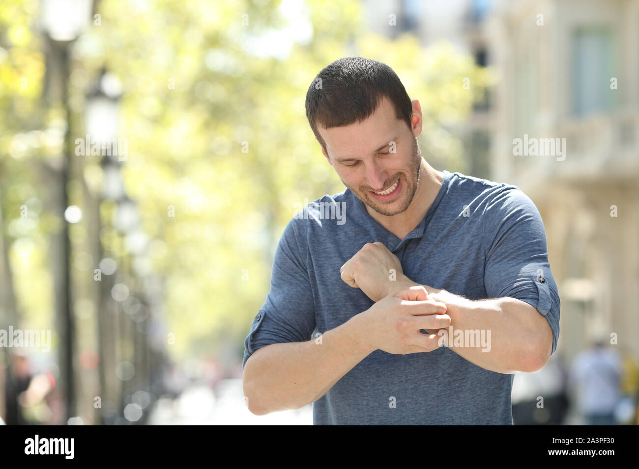 Overwhelmed adult man scratching itchy arm standing in the street Stock Photo