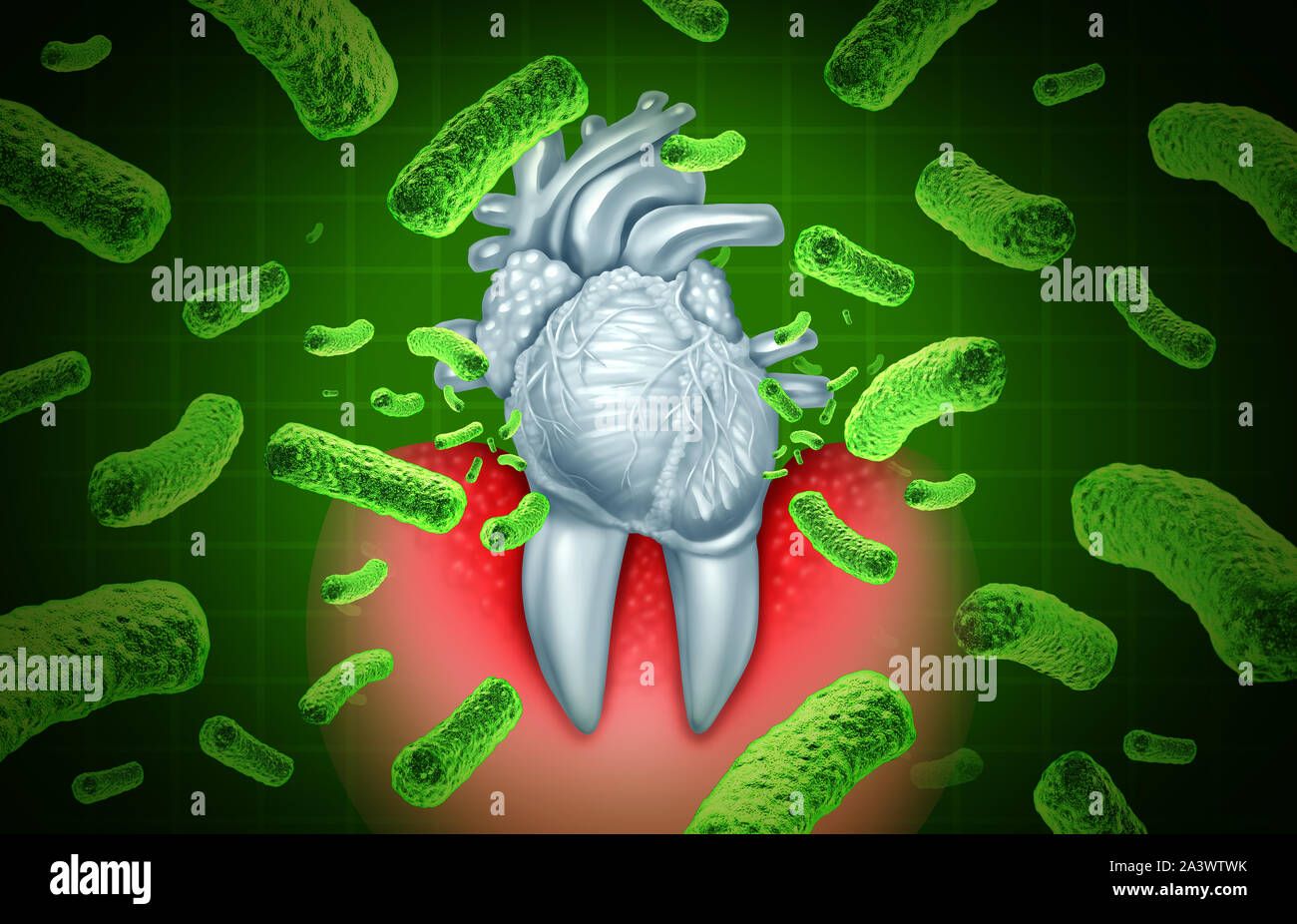 Periodontitis gum disease and poor oral hygiene health problem as a bacteria infection entering the blood stream affecting the human heart damaging. Stock Photo