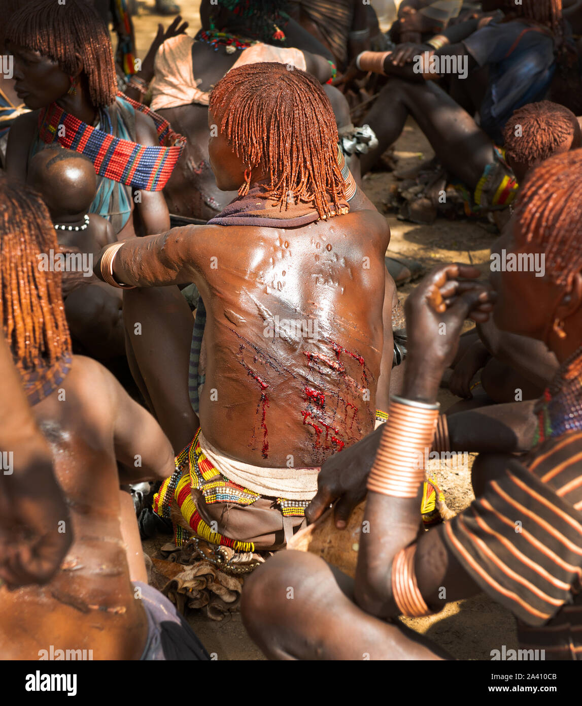 ETHIOPIA: Blood pours from the wounds of a recently whipped woman.  SHOCKING pictures show the strange customs of tribes in the Omo Valley where women Stock Photo