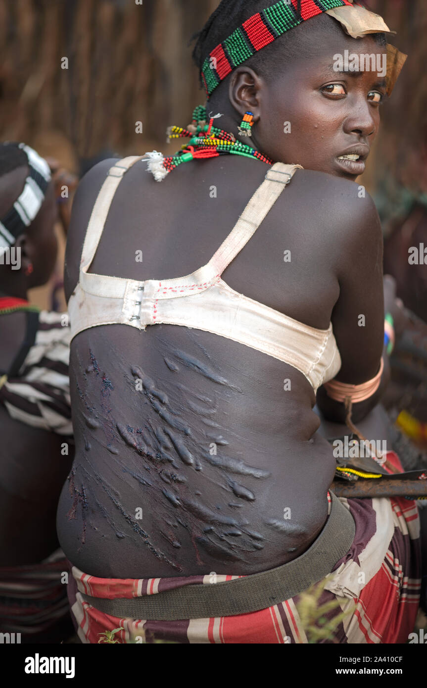 ETHIOPIA: The whippings are welcomed by tribal women and borne as a mark of devotion to their spouse. SHOCKING pictures show the strange customs of tr Stock Photo