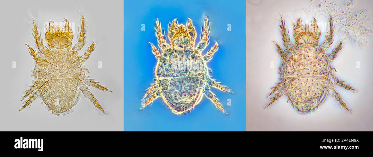 Soil mite, AU-17142 Queensland, Australia. Different imaging illumination examples. Stock Photo