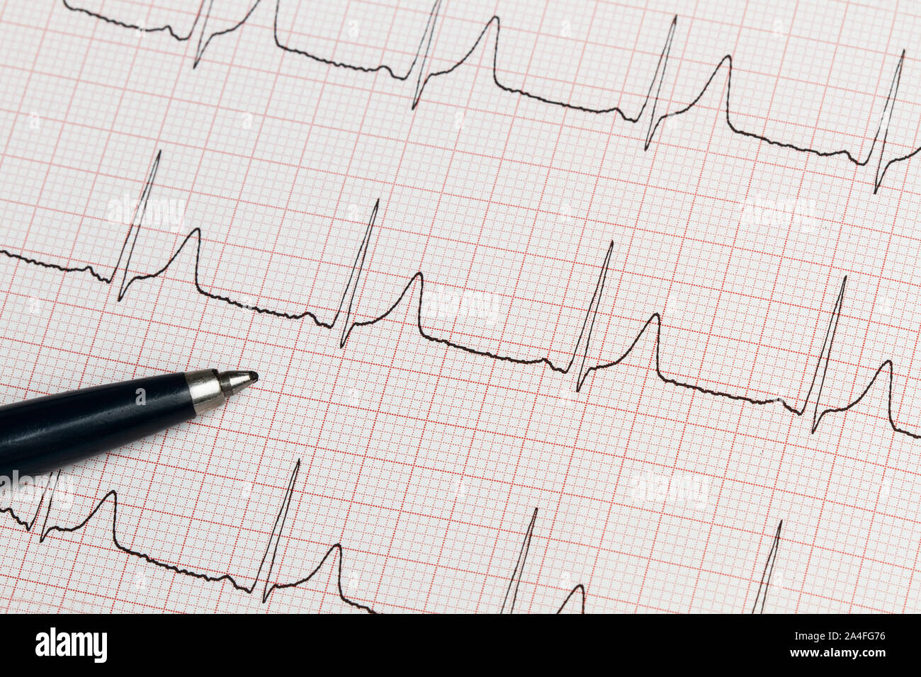 Part of an electrocardiogram printed in paper Stock Photo Alamy