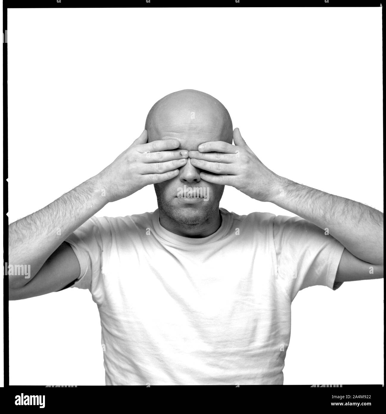 A baldheaded young man holding his hands pressed to his eyes. Blindness. Eyes shut Stock Photo