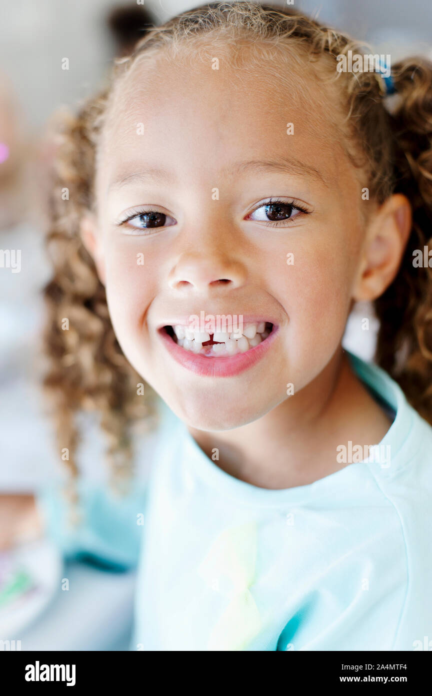 Portrait of girl with missing tooth Stock Photo