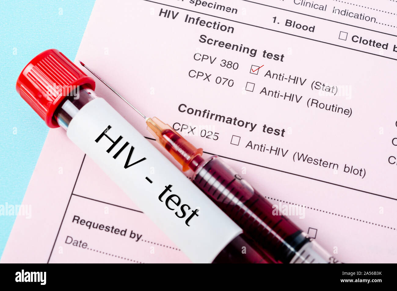 Sample blood in blood tube with HIV test label with needle and syringe on HIV infection screening test form. Stock Photo