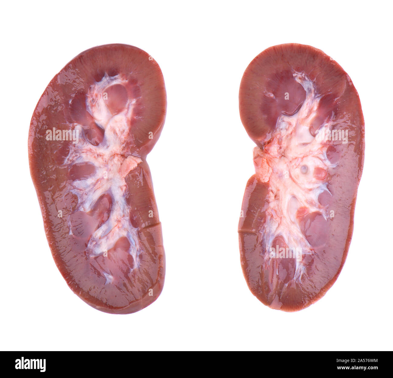 Renal Physiology Stock Photos & Renal Physiology Stock Images Alamy
