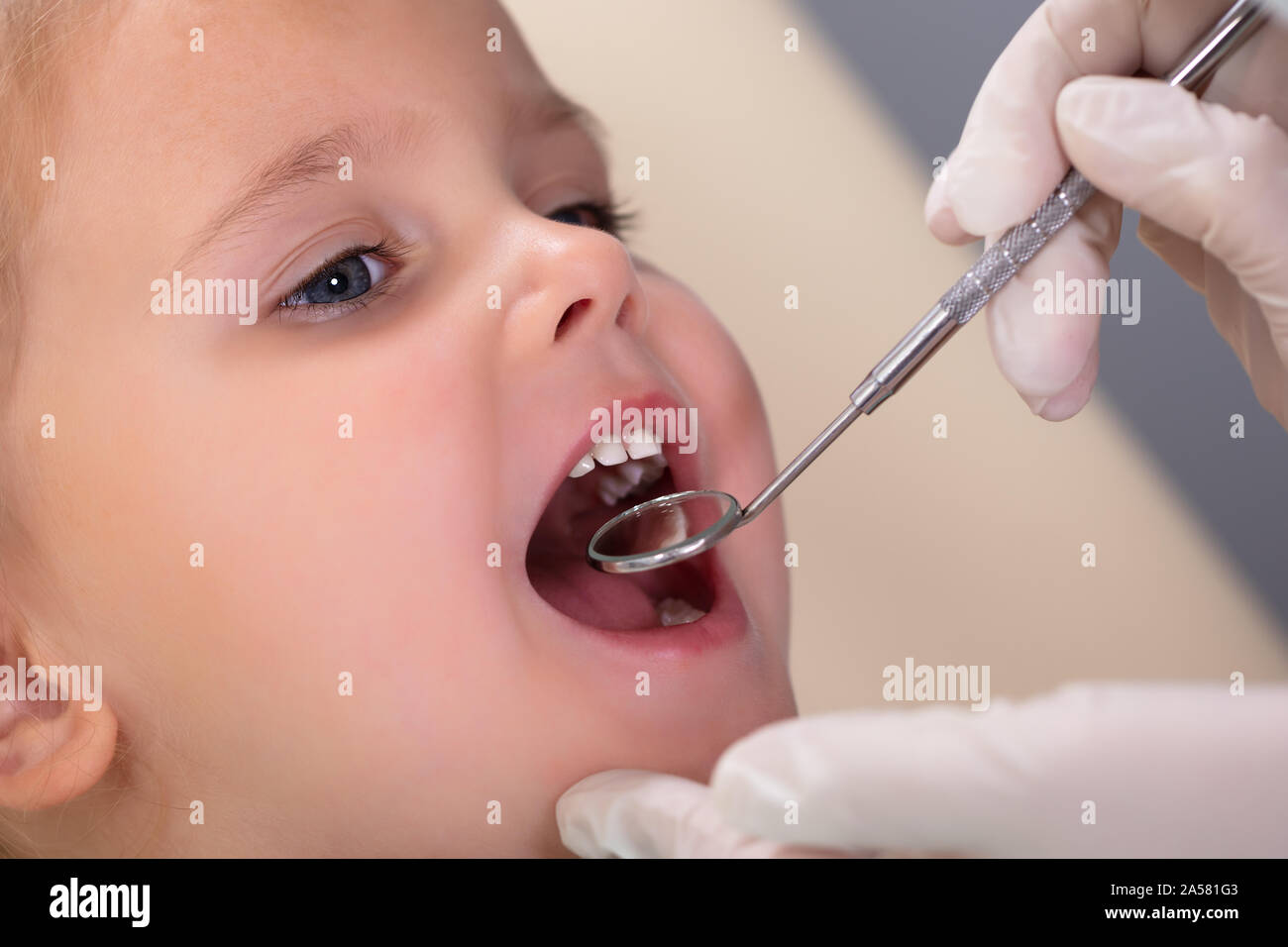 Close-up Of Pediatric Dentist Examining A Little Girl's Teeth In The Dentists Stock Photo