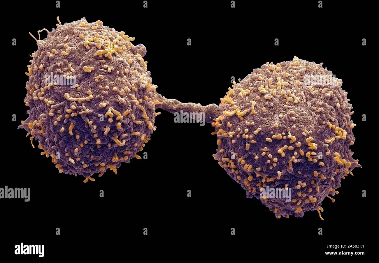 Dividing prostate cancer cells, SEM Stock Photo