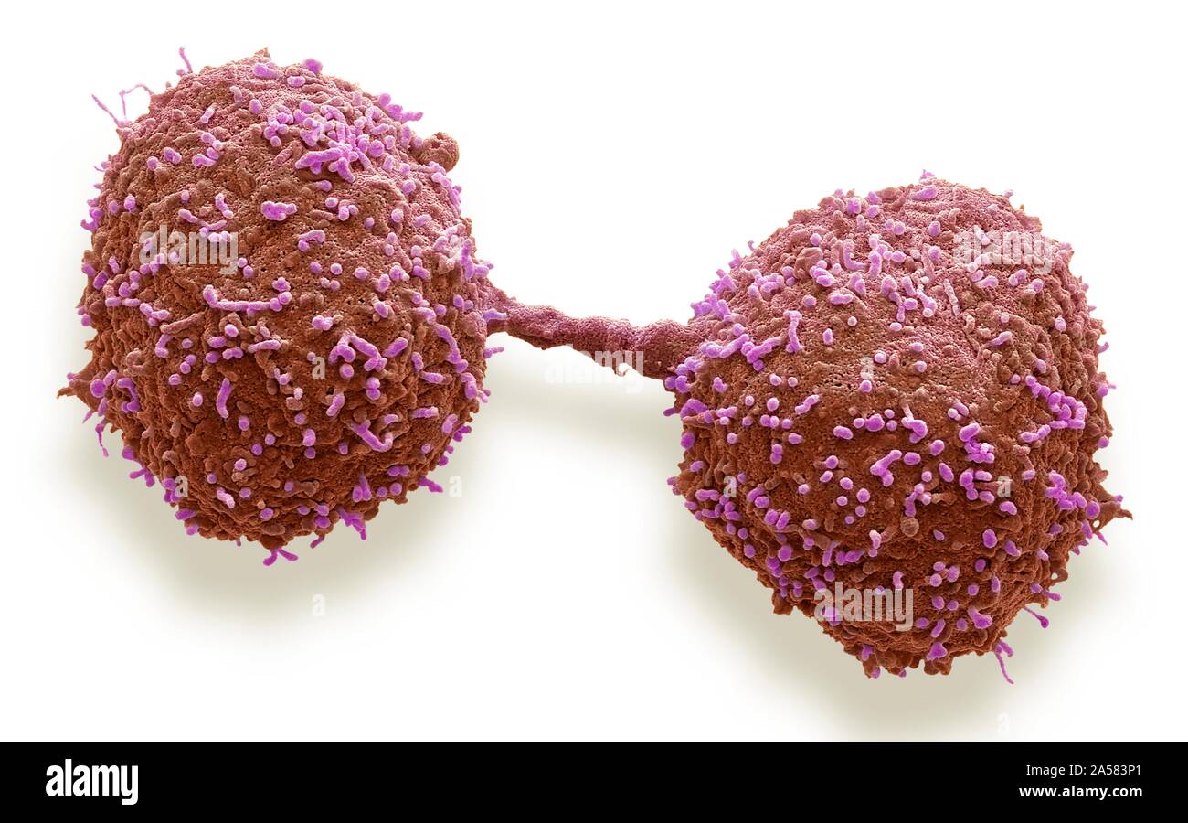 Dividing prostate cancer cells, SEM Stock Photo