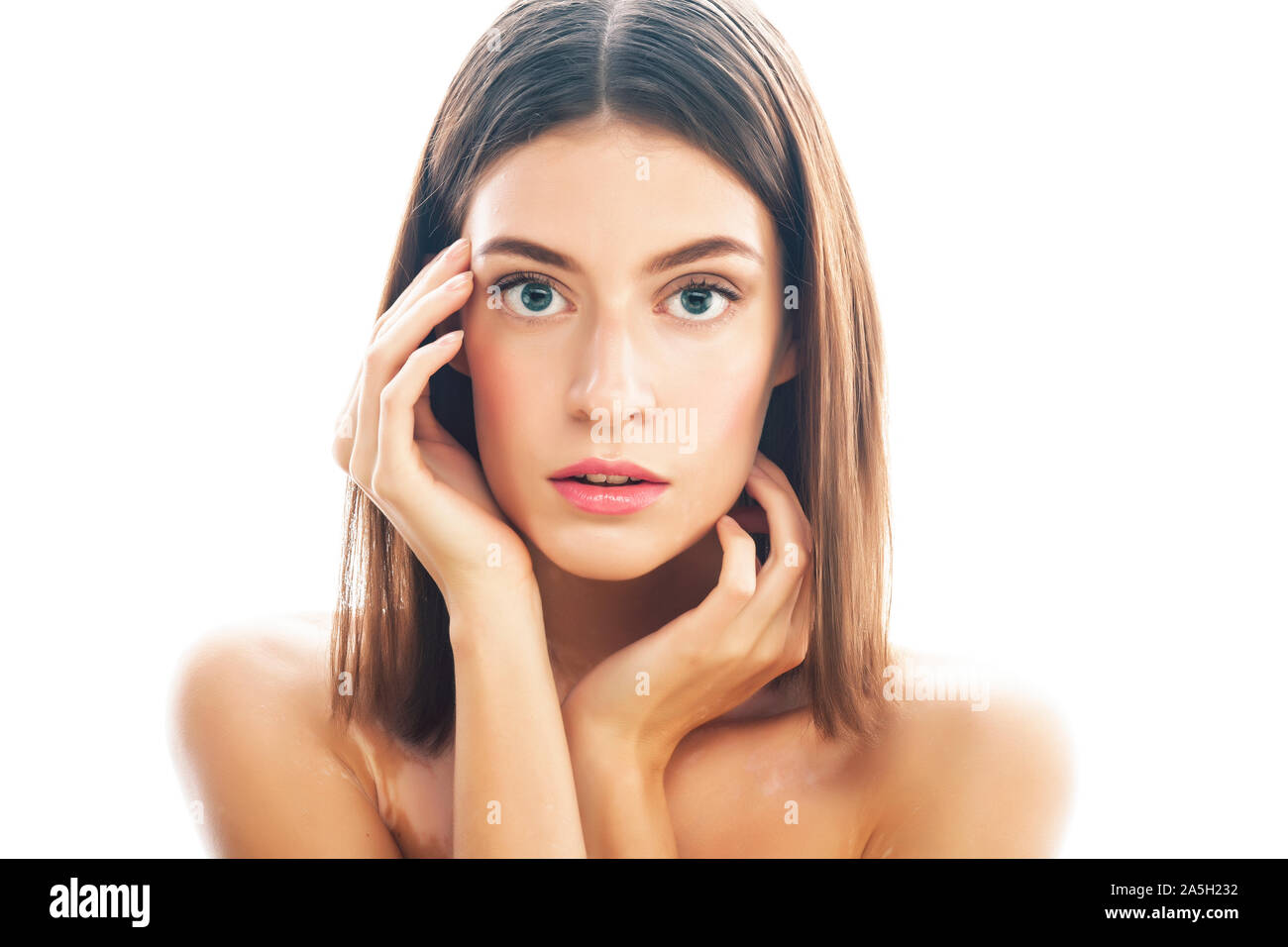 Beautiful Young Brunette Woman With Vitiligo Disease Close Up
