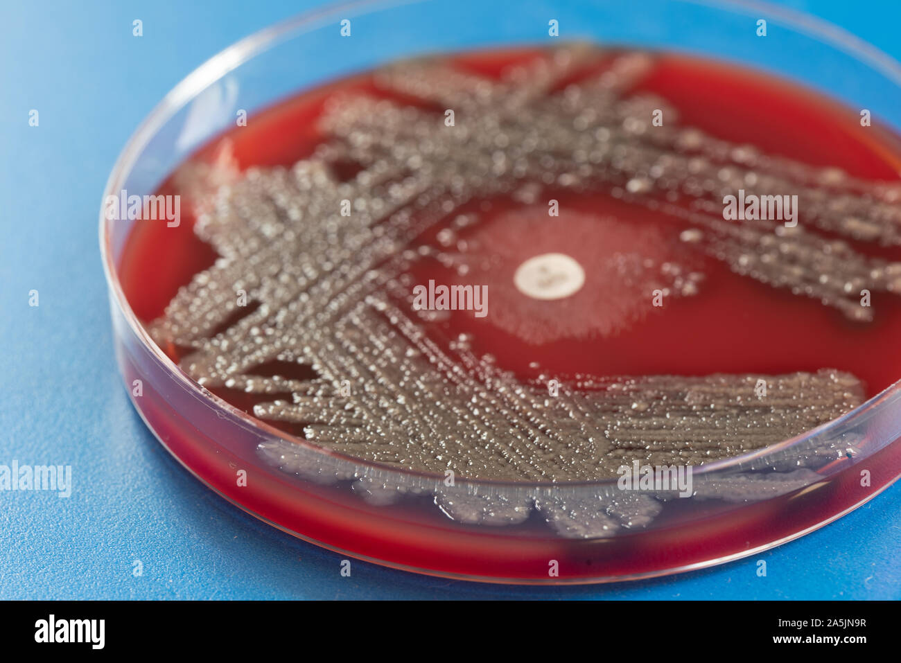 Sowing human feces in a petri dish Stock Photo Alamy