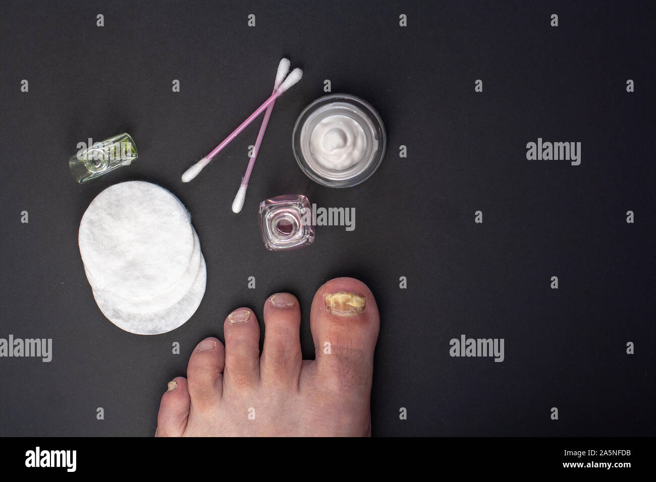 Flat lay. Fungus on the toenail. Tools for the care of affected nails. Cream in a jar, cotton