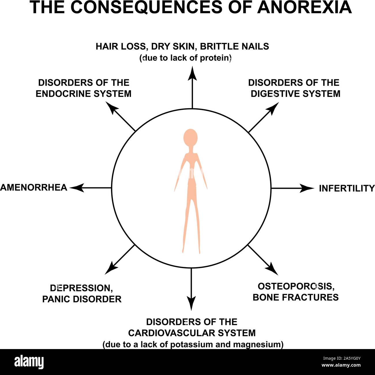 The consequence of which are