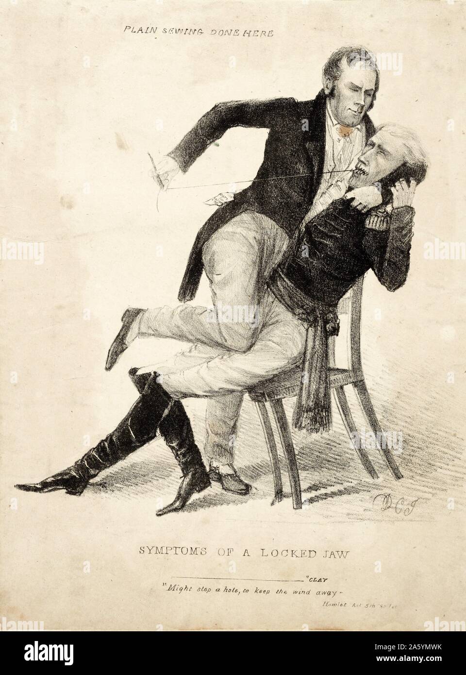 Symptoms of a locked jaw. Plain sewing done here. by David Claypoole Johnston. Circa 1834. Lithograph print on wove paper. Political cartoon representing the feud between Henry Clay and President Andrew Jackson between 1832-1836. During which they battled over the future of the Bank of the United States. The image shows Clay restraining Jackson whilst forcefully sewing up his mouth. Behind them are the words 'Plain sewing done here.' Stock Photo