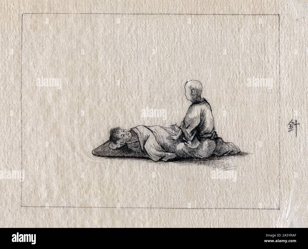 Acupuncturist with a patient. Inscribed in pencil on lower left corner of paper mound : Kano, October 1878. From the 'Medicine' series'. Stock Photo