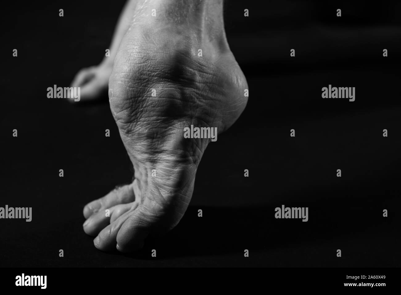 Studio shots of a mans foot with cerebral palsy to show the world how he is able to move and work as a life model and dancer despite his disability. Stock Photo