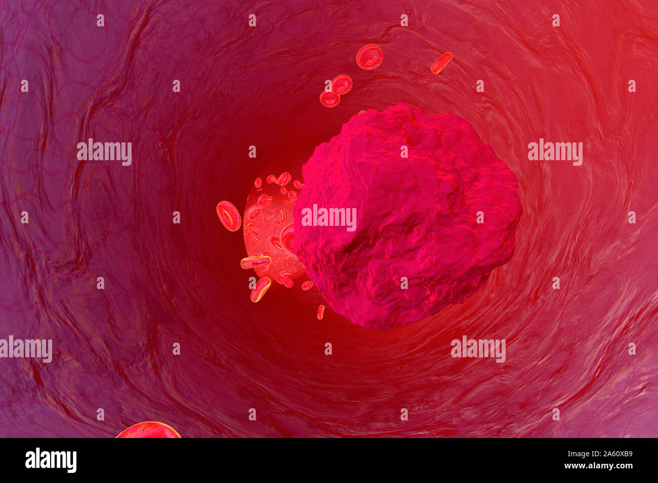 3D rendered Illustration, Mutated leukaemia cell in the lood stream Stock Photo