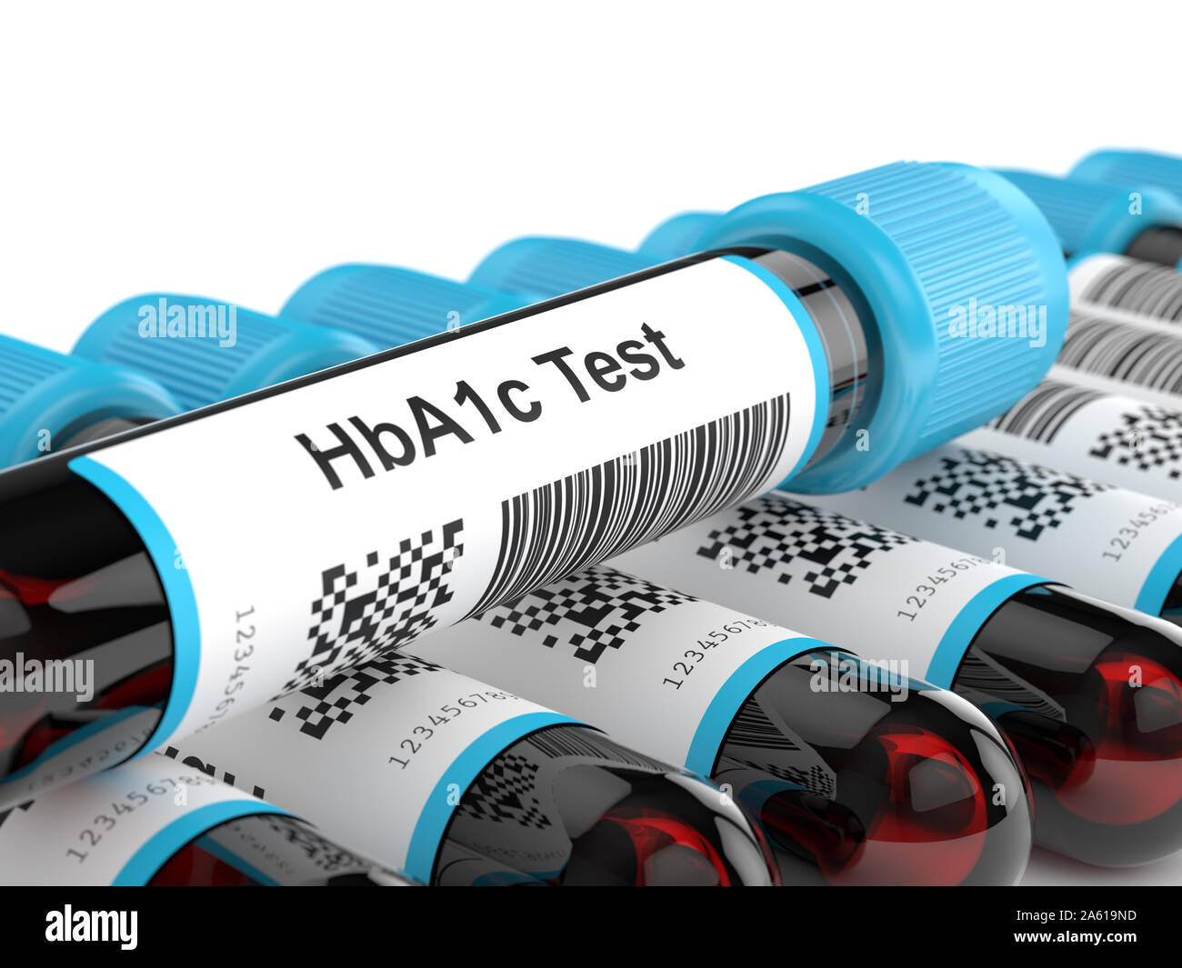 Hemoglobin blood test hires stock photography and images Alamy
