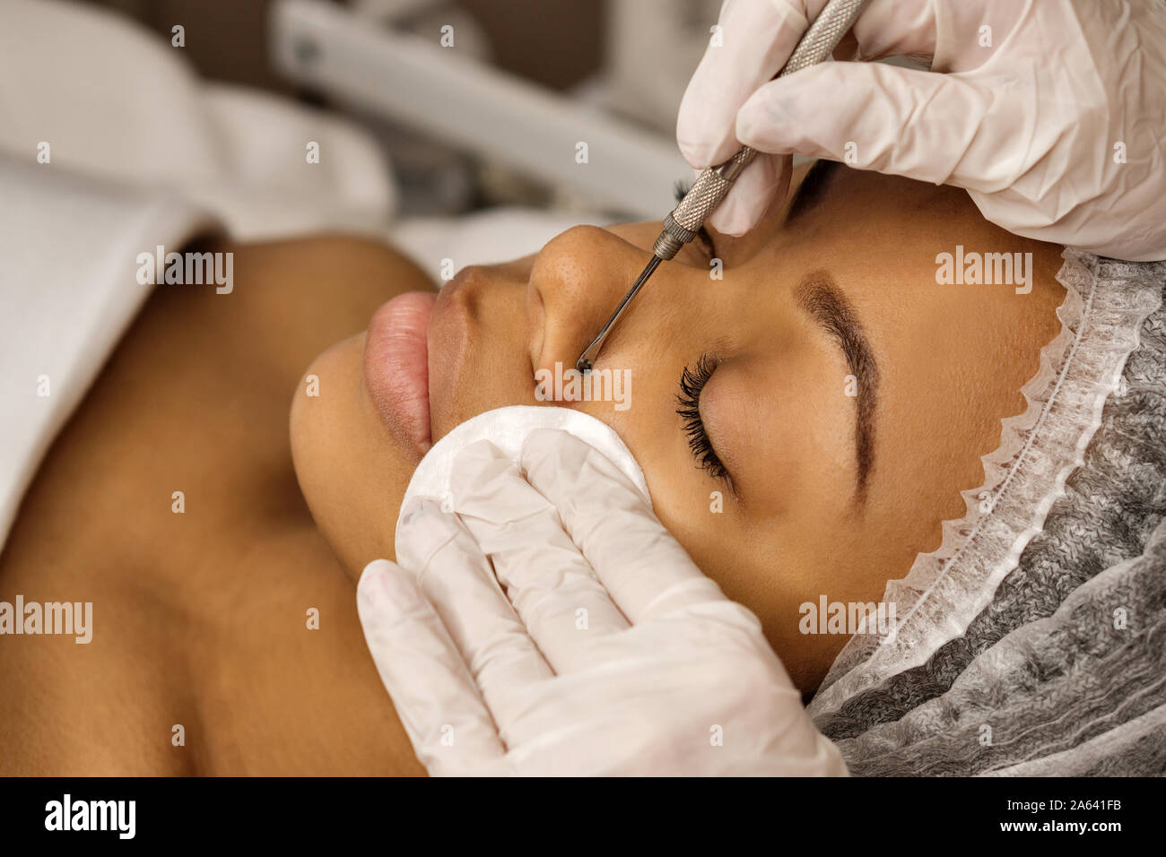 Procedure Mechanical Face Cleaning In Beauty Salon Afro American Young Model Getting Cosmetic Face Skin Care And Treatments In Cosmetologist Spa Co Stock Photo Alamy